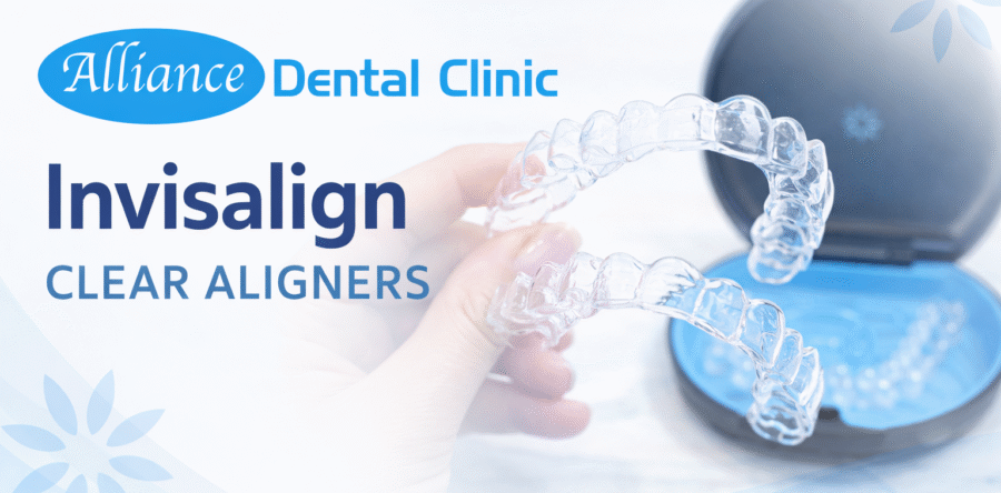 Is Invisalign Faster Than Braces? What Patients in Milton Should Know