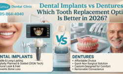 Dental Implants vs Dentures: Which Tooth Replacement Option Is Better in 2026?