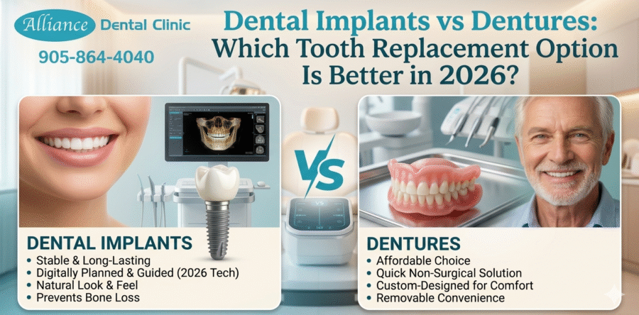Dental Implants vs Dentures: Which Tooth Replacement Option Is Better in 2026?