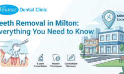Teeth Removal in Milton: Everything You Need to Know