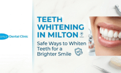 Teeth Whitening in Milton: Safe Ways to Whiten Teeth for a Brighter Smile