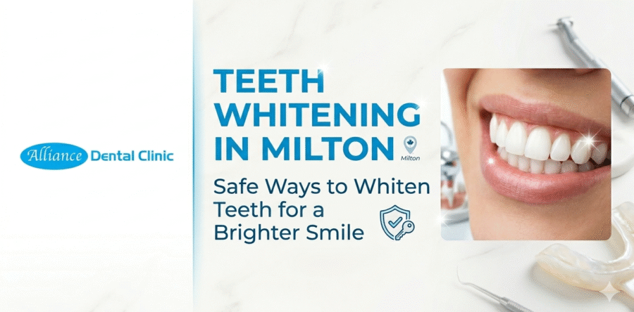 Teeth Whitening in Milton: Safe Ways to Whiten Teeth for a Brighter Smile
