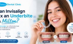 Can Invisalign Fix an Underbite in Milton? The Truth Most People Miss (2026 Guide)