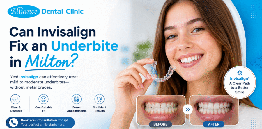 Can Invisalign Fix an Underbite in Milton? The Truth Most People Miss (2026 Guide)