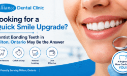 Looking for a Quick Smile Upgrade? Dentist Bonding Teeth in Milton, Ontario May Be the Answer