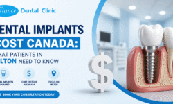 Dental Implants Cost Canada: What Patients in Milton Need to Know
