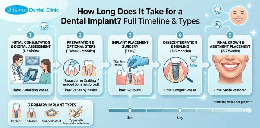 How Long Does It Take for a Dental Implant? Full Timeline & Types