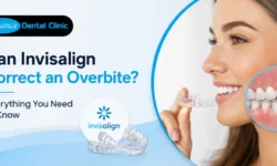 Can Invisalign Correct an Overbite? Everything You Need to Know