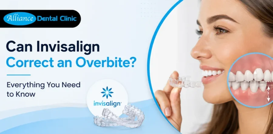 Can Invisalign Correct an Overbite? Everything You Need to Know