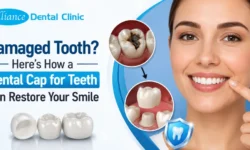Dental Cap for Teeth: How a Dental Crown Restores Your Damaged Smile