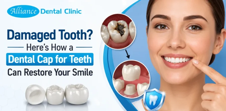 Dental Cap for Teeth: How a Dental Crown Restores Your Damaged Smile