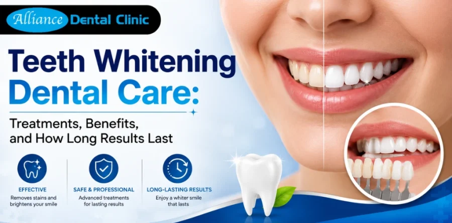 Teeth Whitening Dental Care: Treatments, Benefits, and How Long