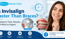 Is Invisalign Faster Than Braces? Treatment Time, Results, and What to Expect