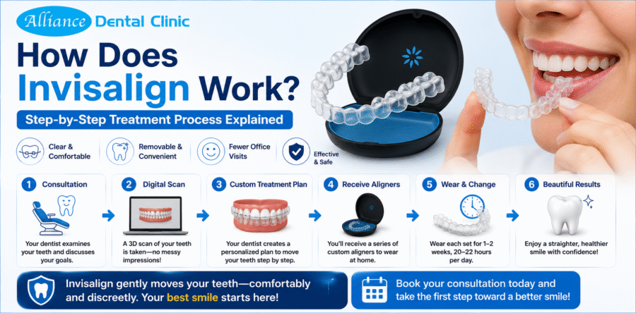 How Does Invisalign Work? Step-by-Step Treatment Process Explained