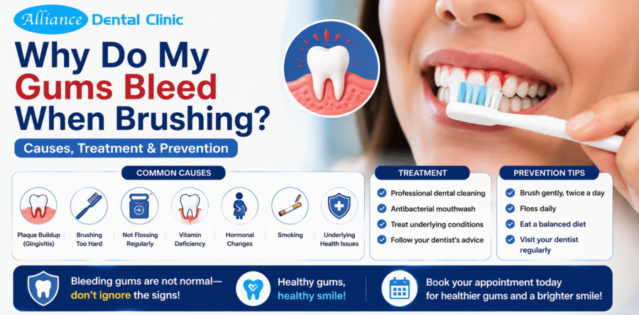Why Do My Gums Bleed When Brushing? Causes, Treatment & Prevention