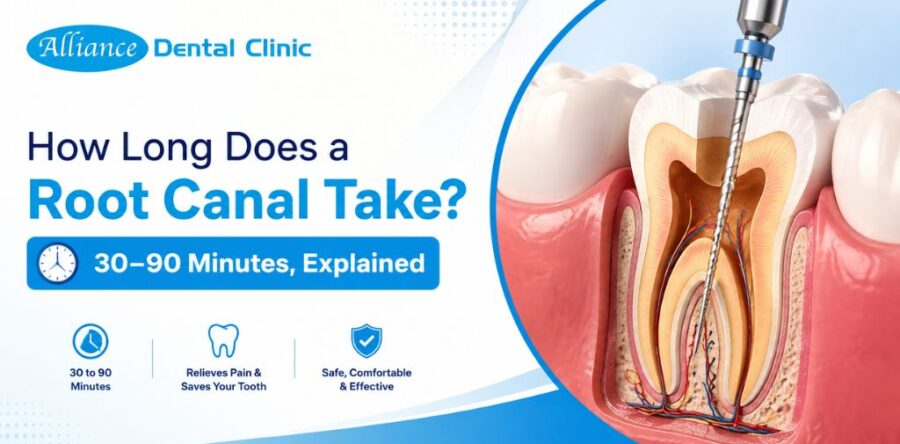 How Long Does a Root Canal Take? 30–90 Minutes, Explained